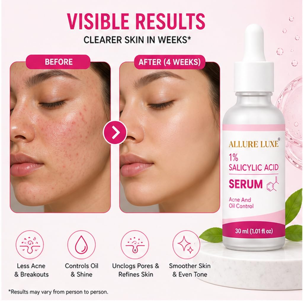 Allure Luxe 1% Salicylic Acid Face Serum for Acne-Prone Skin