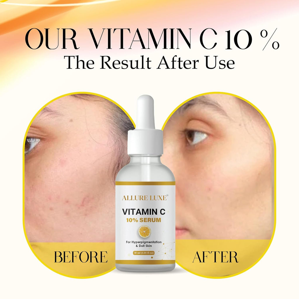 ALLURE LUXE Vitamin C 10% Serum for Hyperpigmentation & Dull Skin, 30 ml, Brightening Face Serum with Collagen Boosting Formula