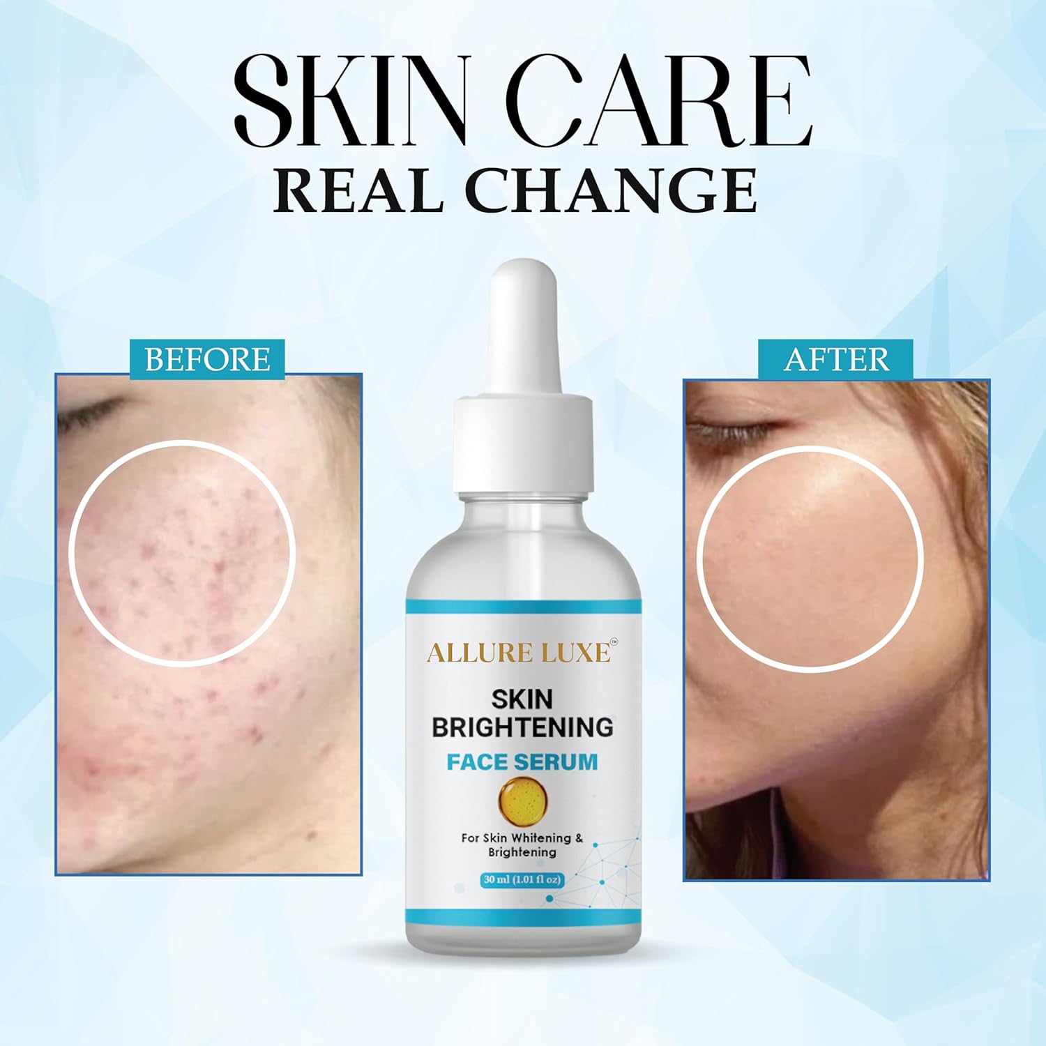 ALLURE LUXE Skin Brightening Face Serum for Dark Spot Reduction, Pigmentation Treatment, 30 ml