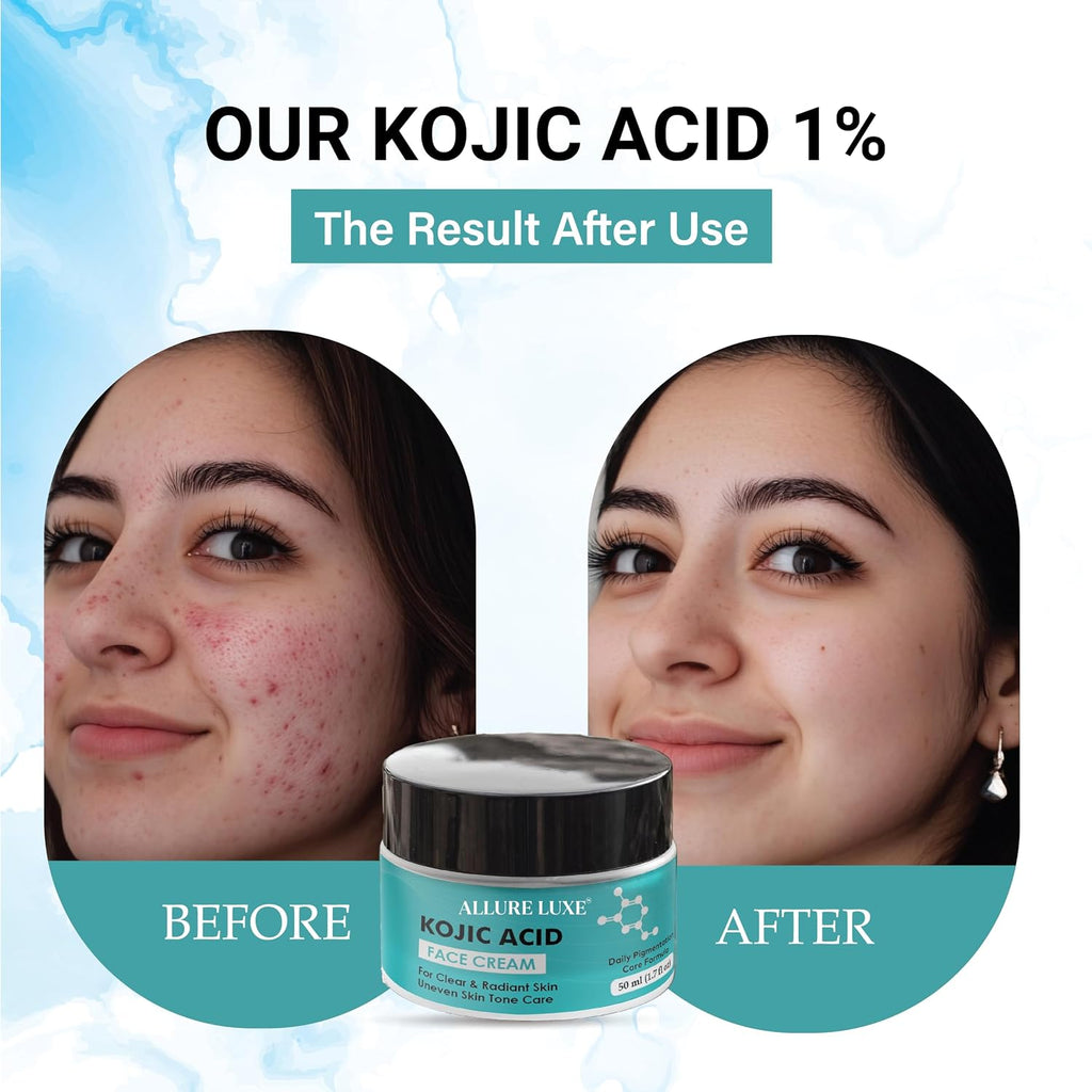 Allure Luxe Kojic Acid Face Cream, with Niacinamide & Alpha Arbutin, Pigmentation Care Formula, 50 ml