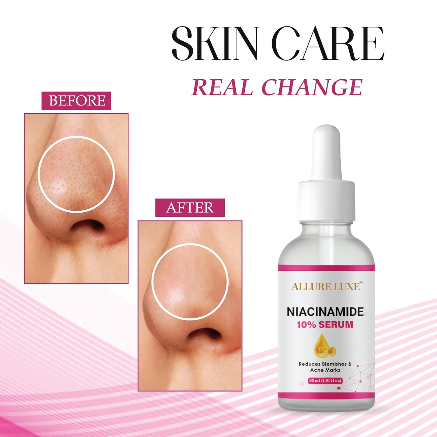 ALLURE LUXE Niacinamide 10% Serum with Hyaluronic Acid for Dark Spot Reduction, Blemishes and Acne Marks, 30ml