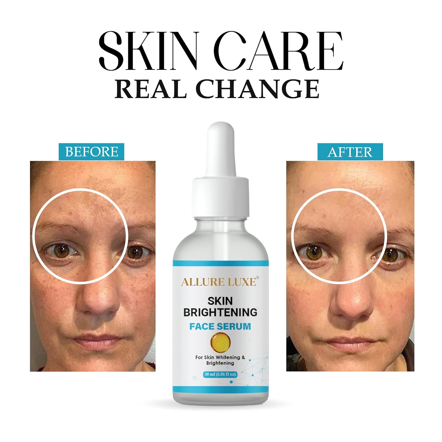 ALLURE LUXE Skin Brightening Face Serum for Dark Spot Reduction, Pigmentation Treatment, 30 ml