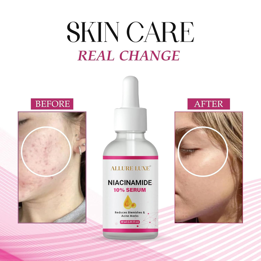 ALLURE LUXE Niacinamide 10% Serum with Hyaluronic Acid for Dark Spot Reduction, Blemishes and Acne Marks, 30ml